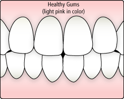 Healthy Gums